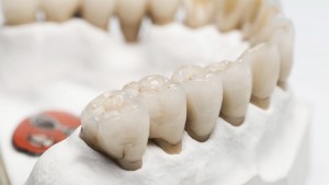 Laboaroire Bienfait - Prothésiste dentaire